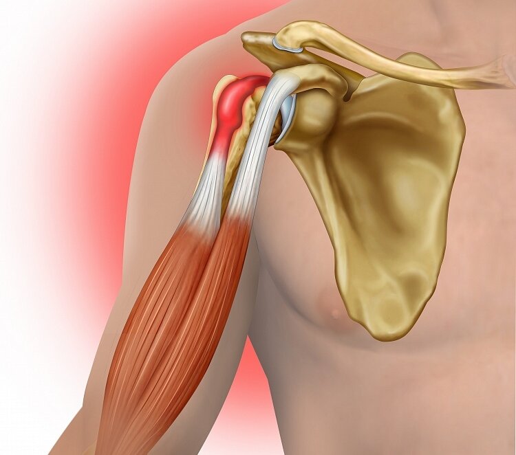 Периартрит - симптомы, причины и лечение | «СМ-Клиника»