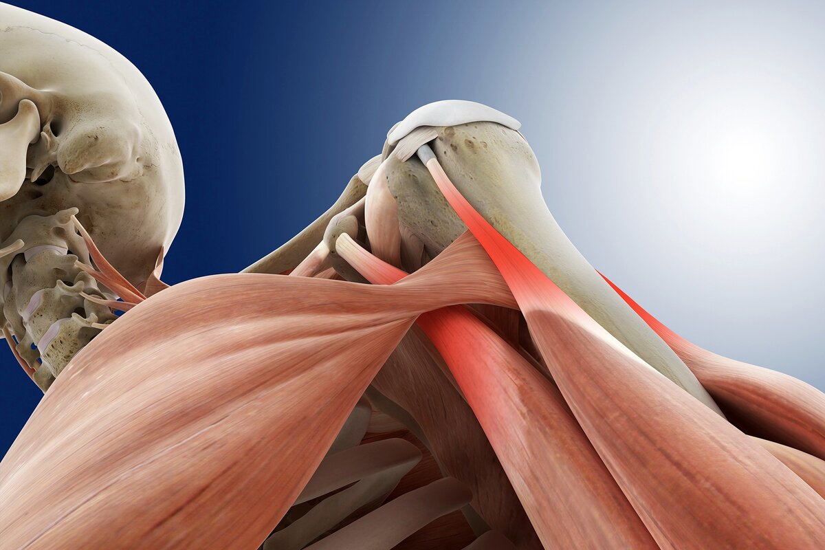 Плечелопаточный периартрит анатомия