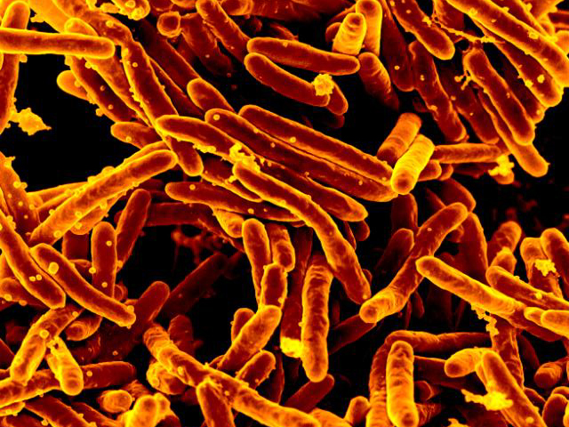 Mycobacteroides abscessus. Иллюстрация: en.wikipedia.org