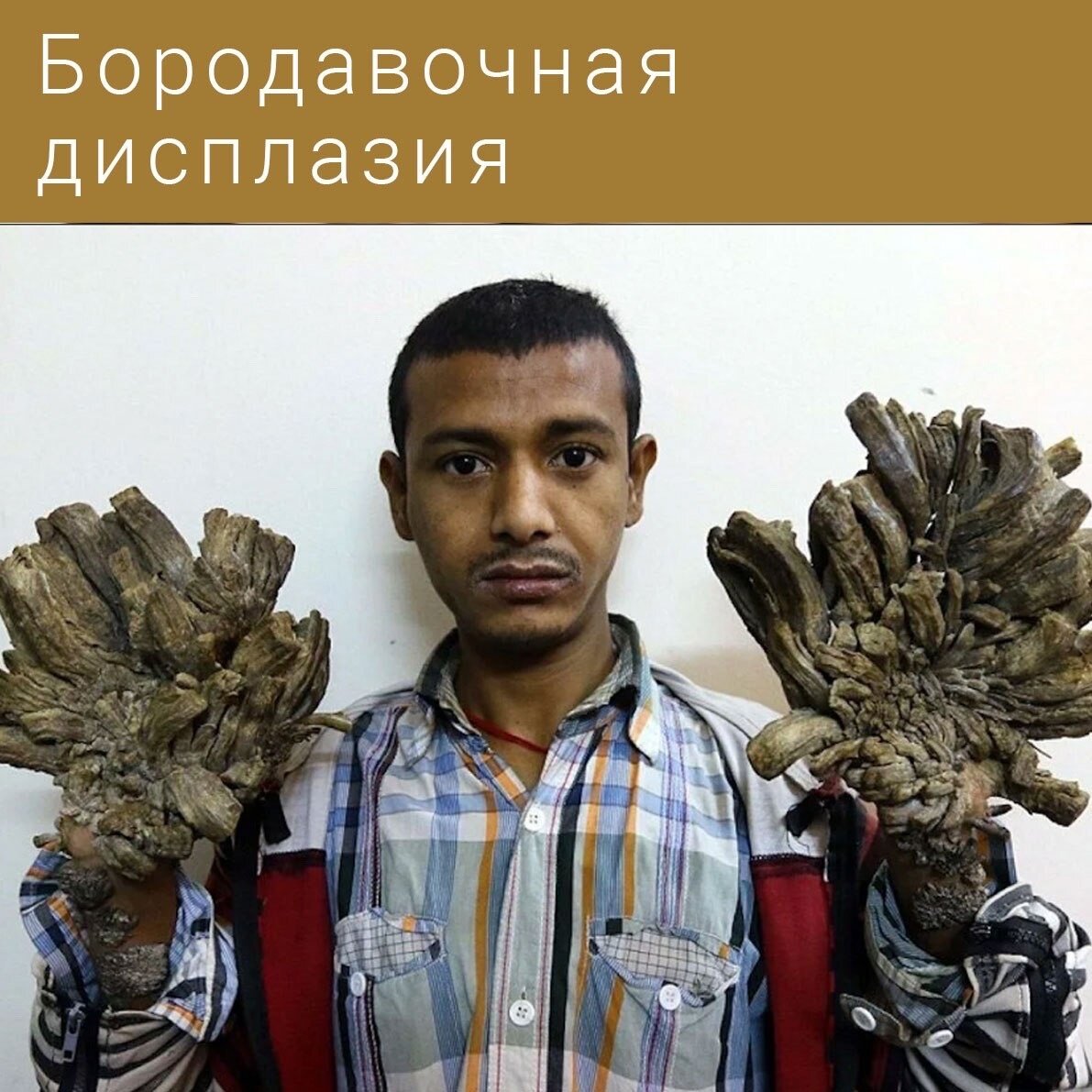 деревья обнимаются. дерево арболь дель туле. люди деревья как называются. люди деревья как называются. самое большое дерево в мире баобаб.