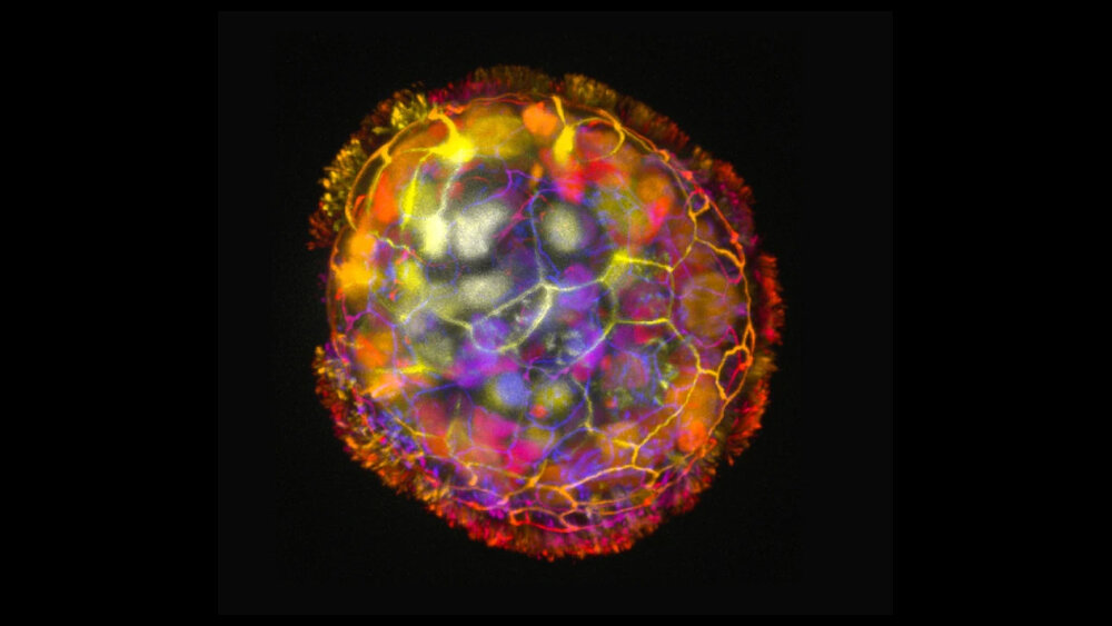    Фото: Gizem Gumuskaya/Tufts University