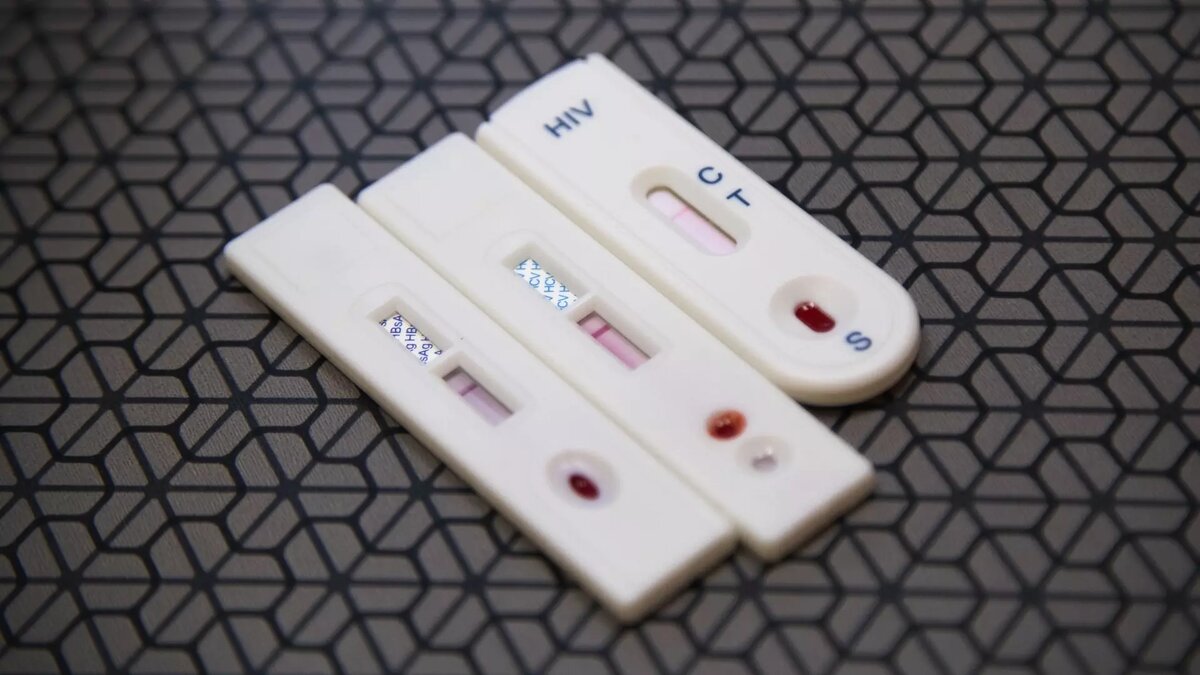     ВИЧ остается одной из серьезнейших медицинских проблем в мире. Однако соблюдение определенных мер предосторожности может значительно снизить риск заражения. Специалисты дали советы на пресс-конференции в Нижнем Новгороде 1 декабря.