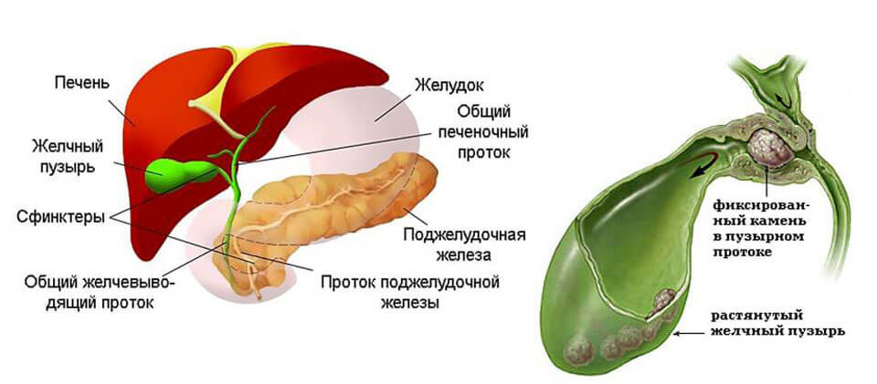 Тем у кого удален желчный пузырь. Желчный пузырь система органов пищеварения. Острый флегмонозный холецистит. Печень и желчный пузырь. Тем у кого удален желчный пузырь.