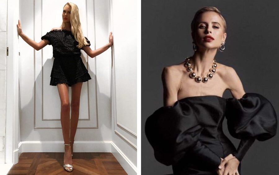    худые звезды