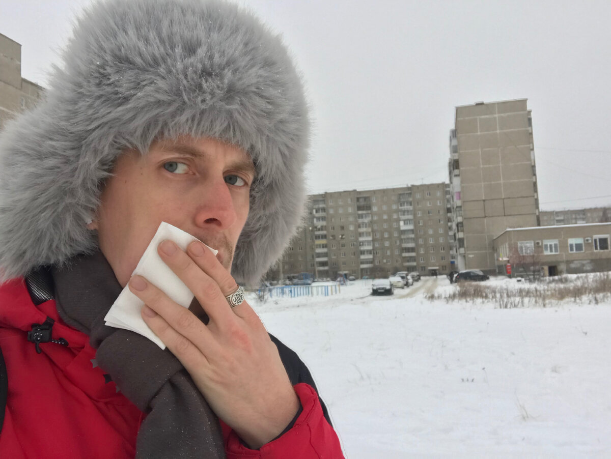 Я после стоматологии. Глаза полные жизни, правда?
