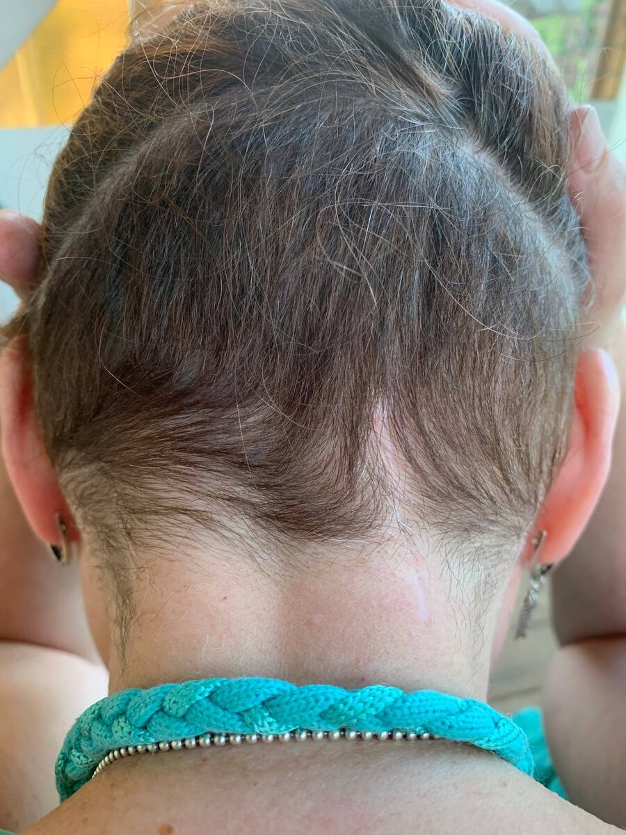 А это под шевелюрой.