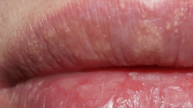    СПб ГБУЗ «Кожно-венерологический диспансер № 4»