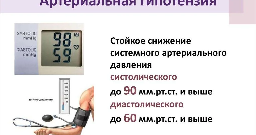 Резко упало давление: чем это опасно, роль стрессов, переутомления и болезней
