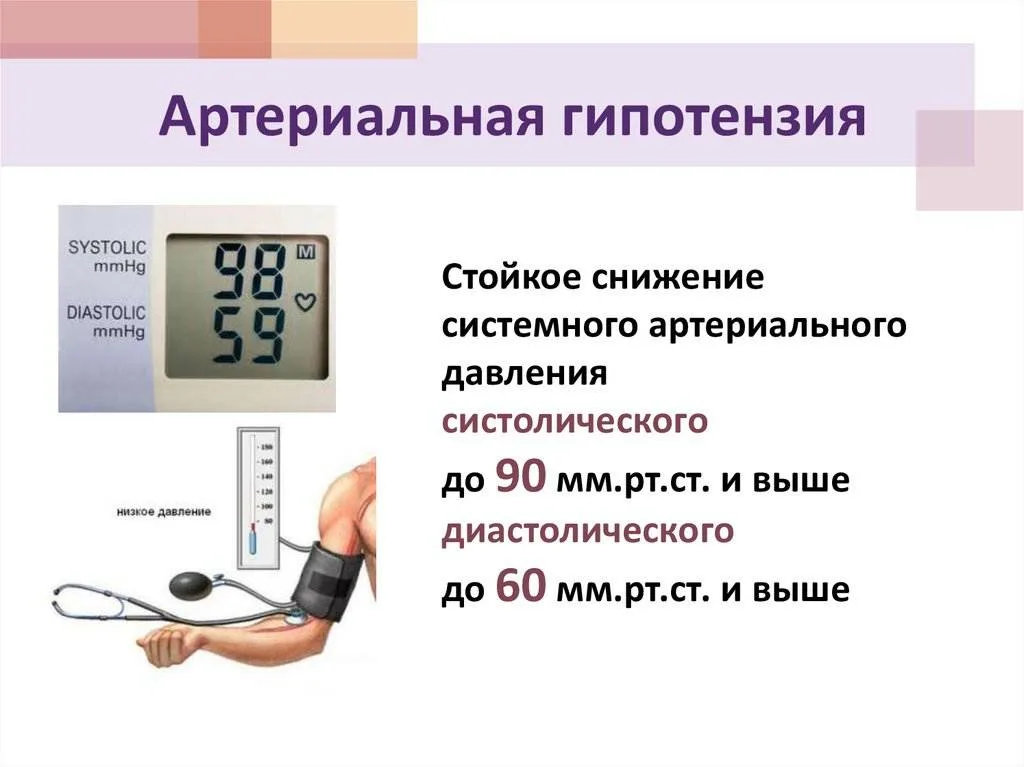 Давления оса. Артериальная гипотензия (систолическое ад менее 90 мм РТ.ст.);. Артериальное давление при гипотонии. Артериальная гипотензия симптомы причины. Артериальная гипотензия возникает при.