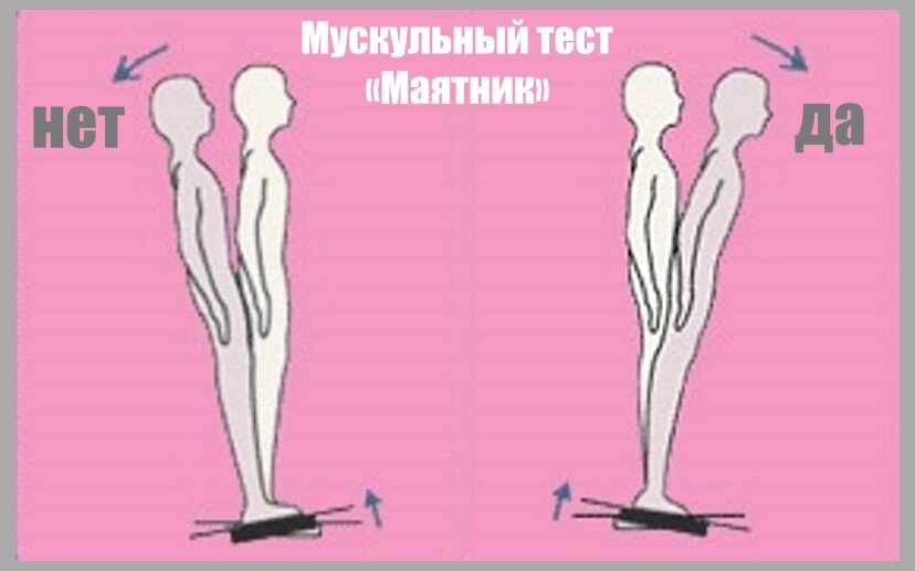 Мускульный тест стоя - «Маятник»