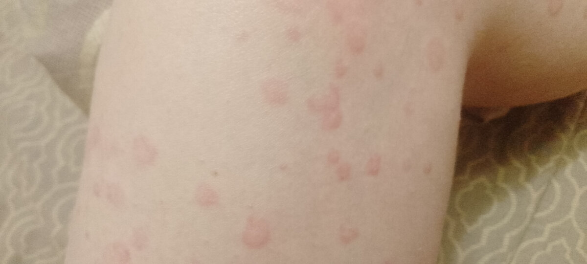 Личное фото. 