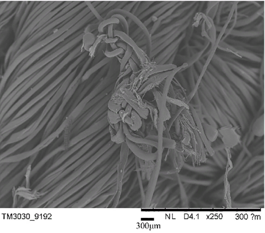 Примерно так это выглядит под микроскопом