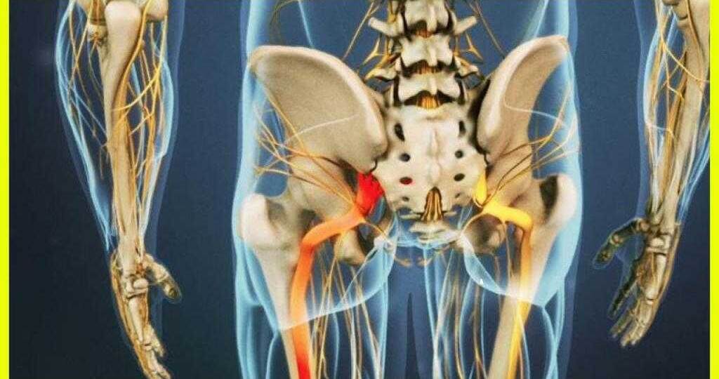 БОЛЬ В БЕДРЕ. Почему болит бедро и как его лечить?