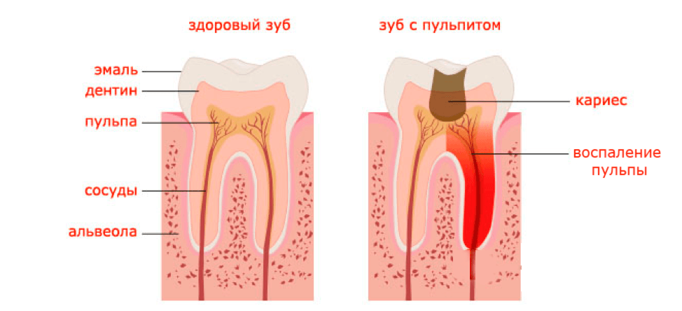 Диагностика зубов