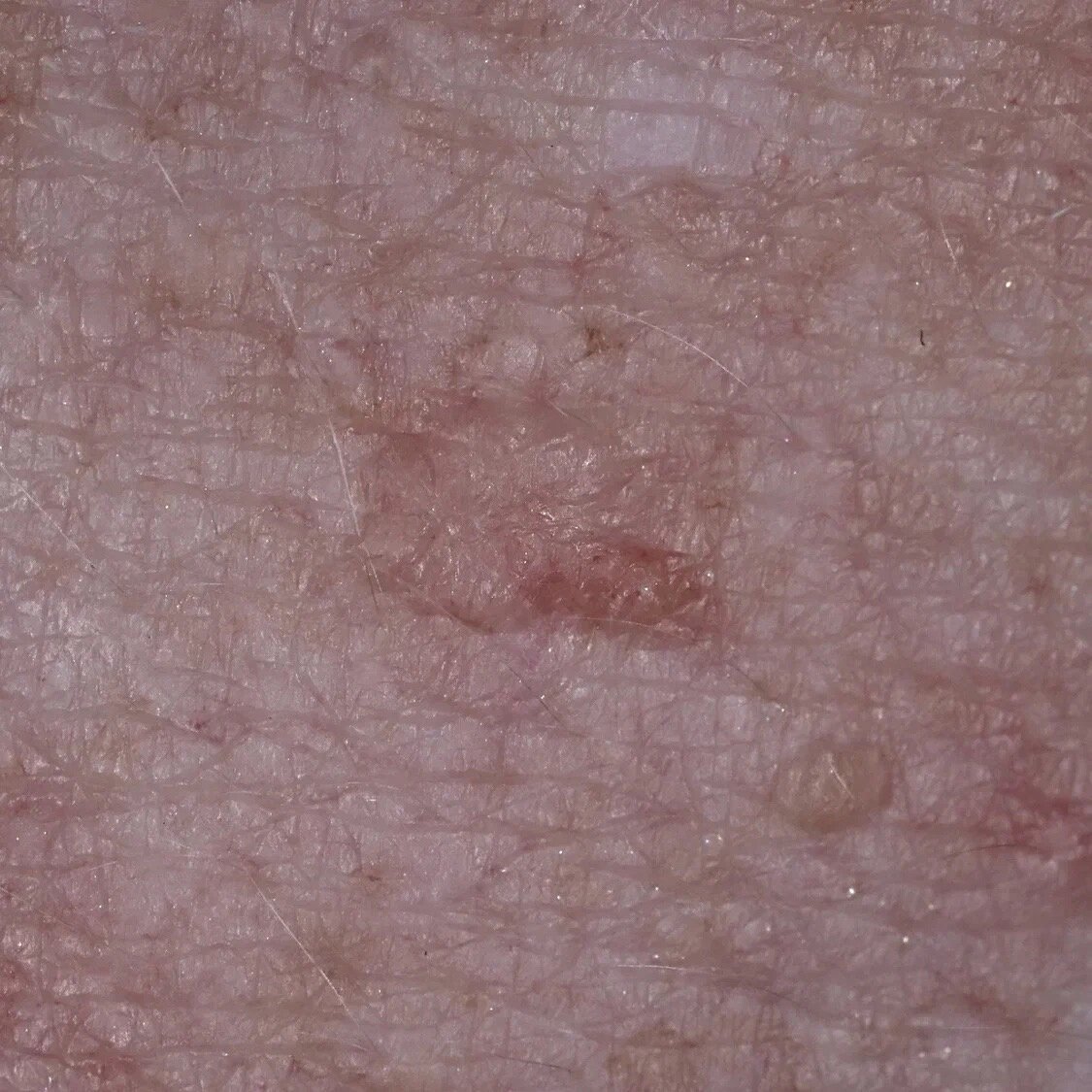  клиническое фото