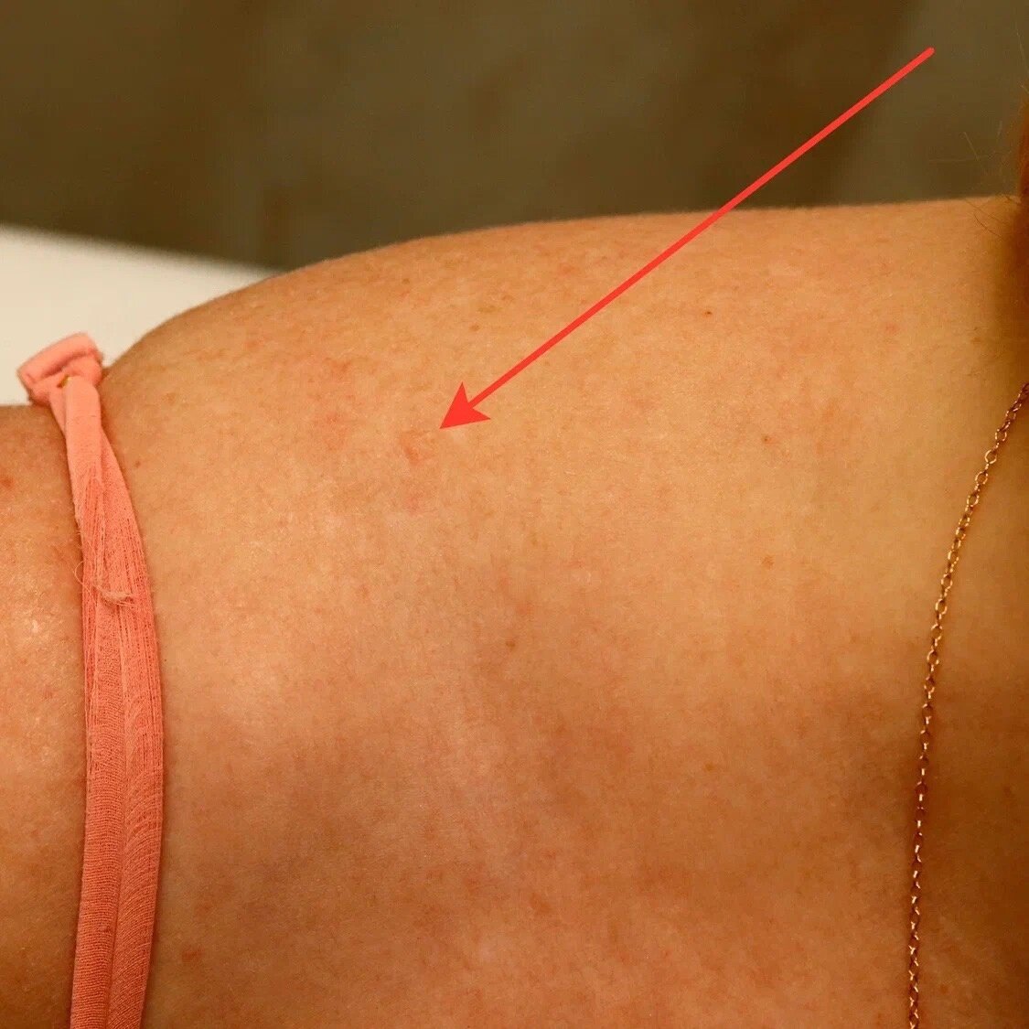 обзорное фото