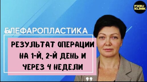 Блефаропластика. Результат на 1-й, 2-й день, а также через 4 недели ☝️ Показываем вам как довольны наши пациентки 💪