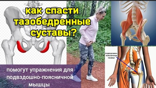 Жалобно ноют тазобедренные суставы, ворчит поясница? Виноват спазм подвздошно-поясничной мышцы. Упражнения