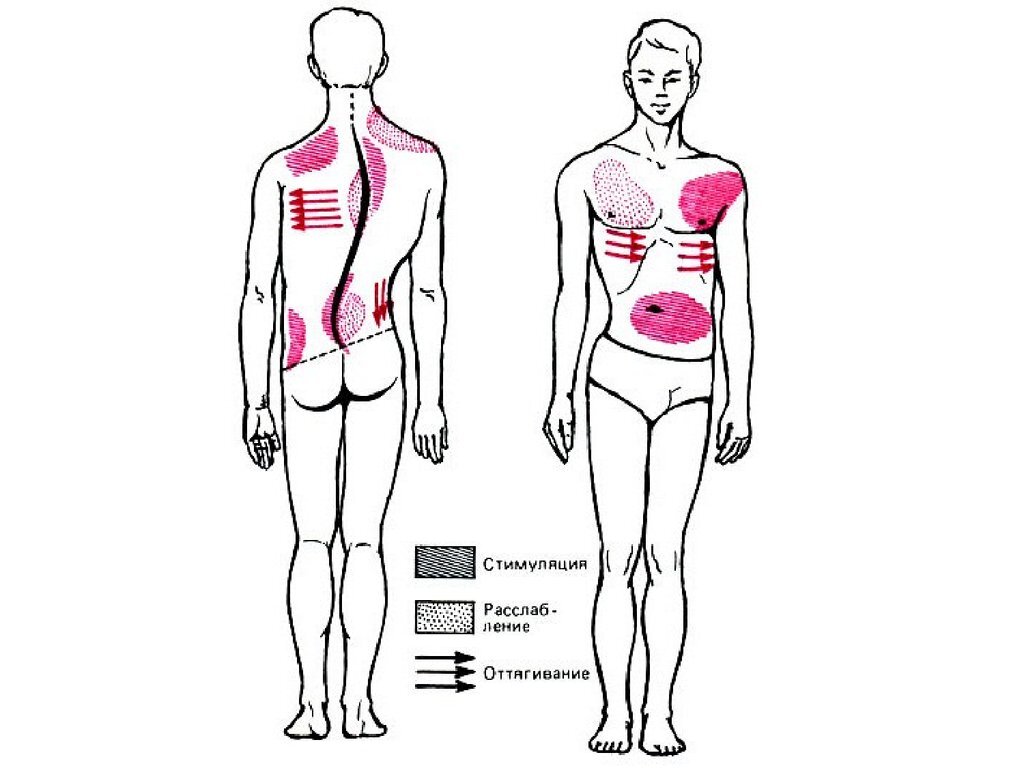 Дифференцированный массаж. Дифференцируемый массаж. Массаж при сколиозе у подростков. Лечебный массаж при сколиозе. Методики дифференцированного массажа.