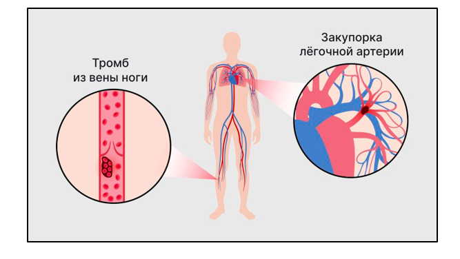 Рассказывает врач терапевт - кардиолог Моисеенко Марина Сергеевна.
Для начал разберем несколько понятий.-2