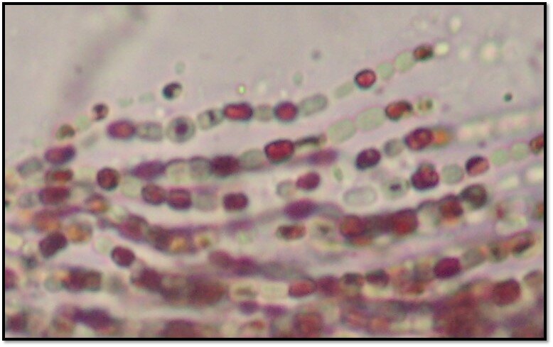 Это моя сине-зеленая микроводоросль Anabaenopsis.sp. , у которой проверяется жизнеспособность с помощью окрашивания формазаном. Красные - живые, зеленые мертвые. А мертвые потому,что они были в температуре -196 градусов в жидком азоте. Криоконсервированы.