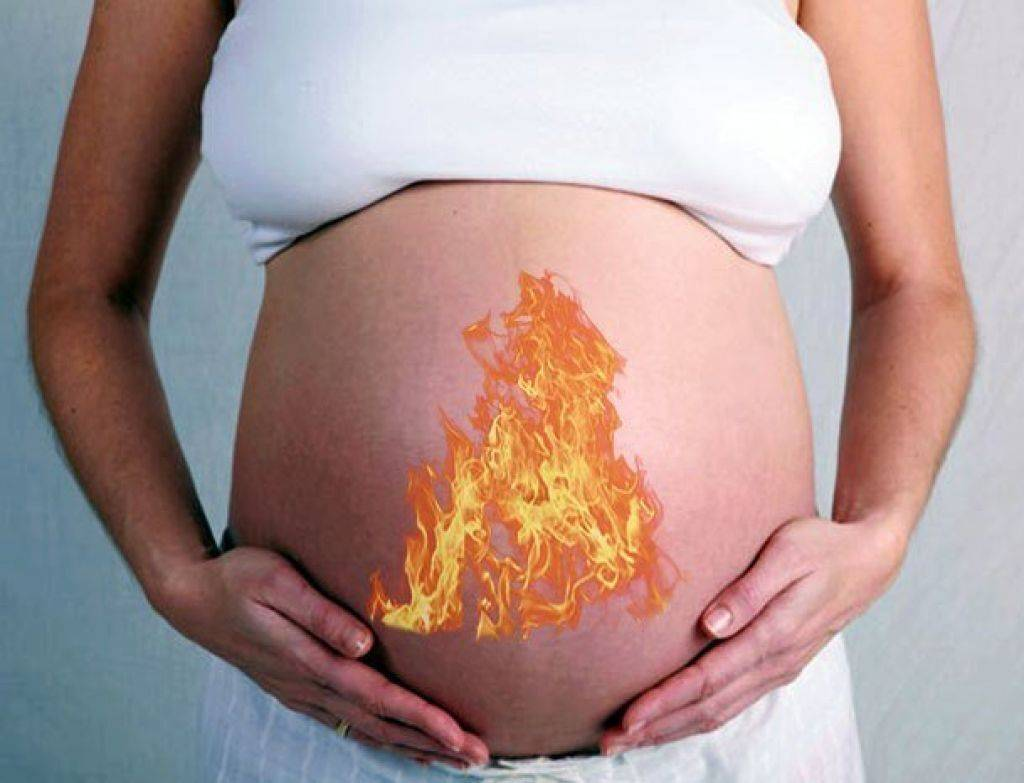 31 неделя болит живот. Изжога при беременности. Изжоге прибеременночти. Изжога беременность 3 триместр.