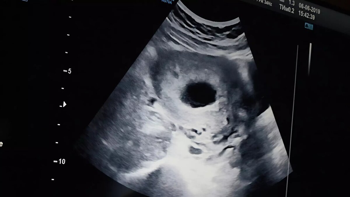     По мнению Ксении Горячевой, новые предложения ничего полезного в себе не несут. Они не будут мотивировать женщин рожать и могут обернуться негативными последствиями.