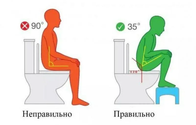 Классическая поза сидения на унитазе не является физиологичной, но ее можно скорректировать с помощью подставок для ног