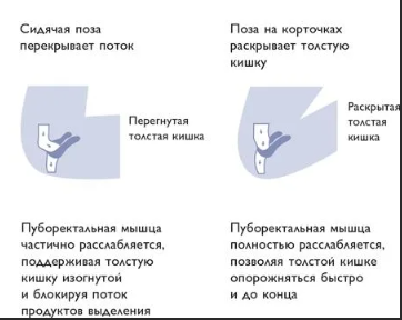 Запор: причины, симптомы, лечение