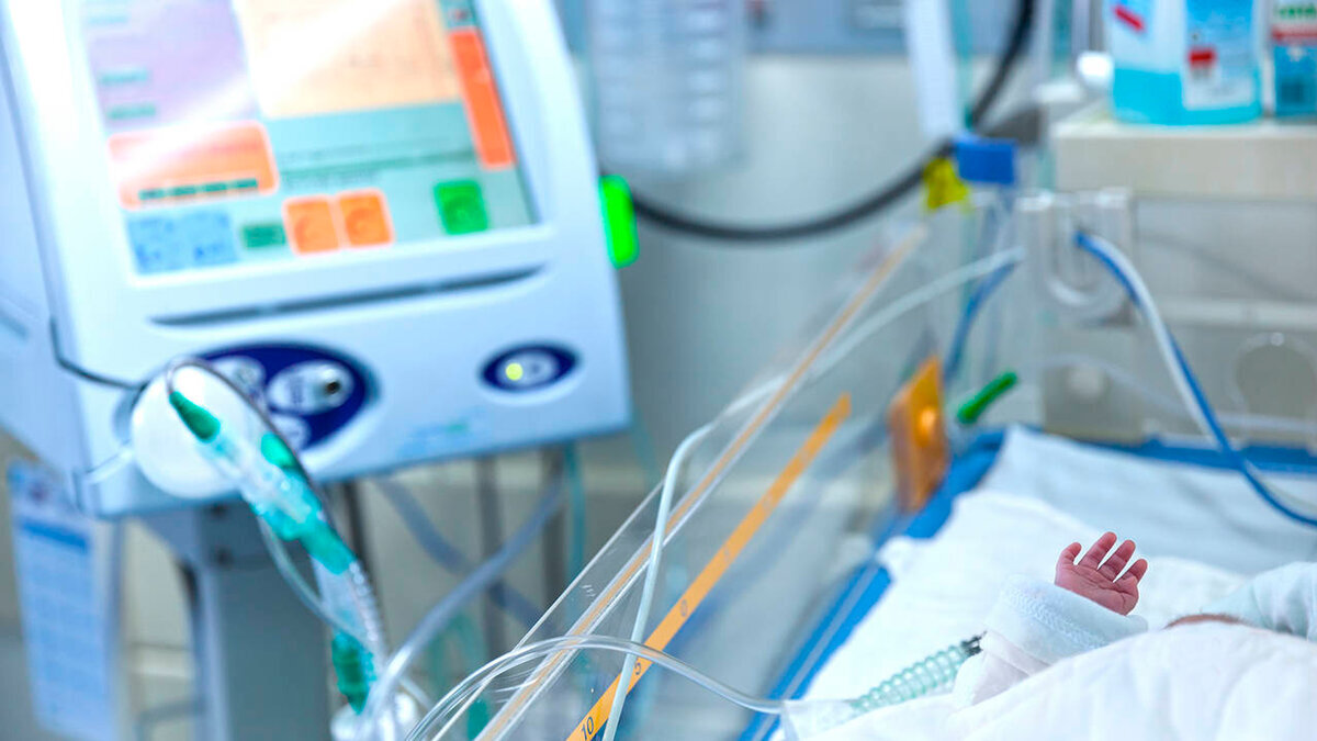 Состояние новорожденных в реанимации. Новорожденный ребенок в реанимации. Реанимация новорожденного. Реанимация новорожденного. Реанимация для новорожденных недоношенных детей.