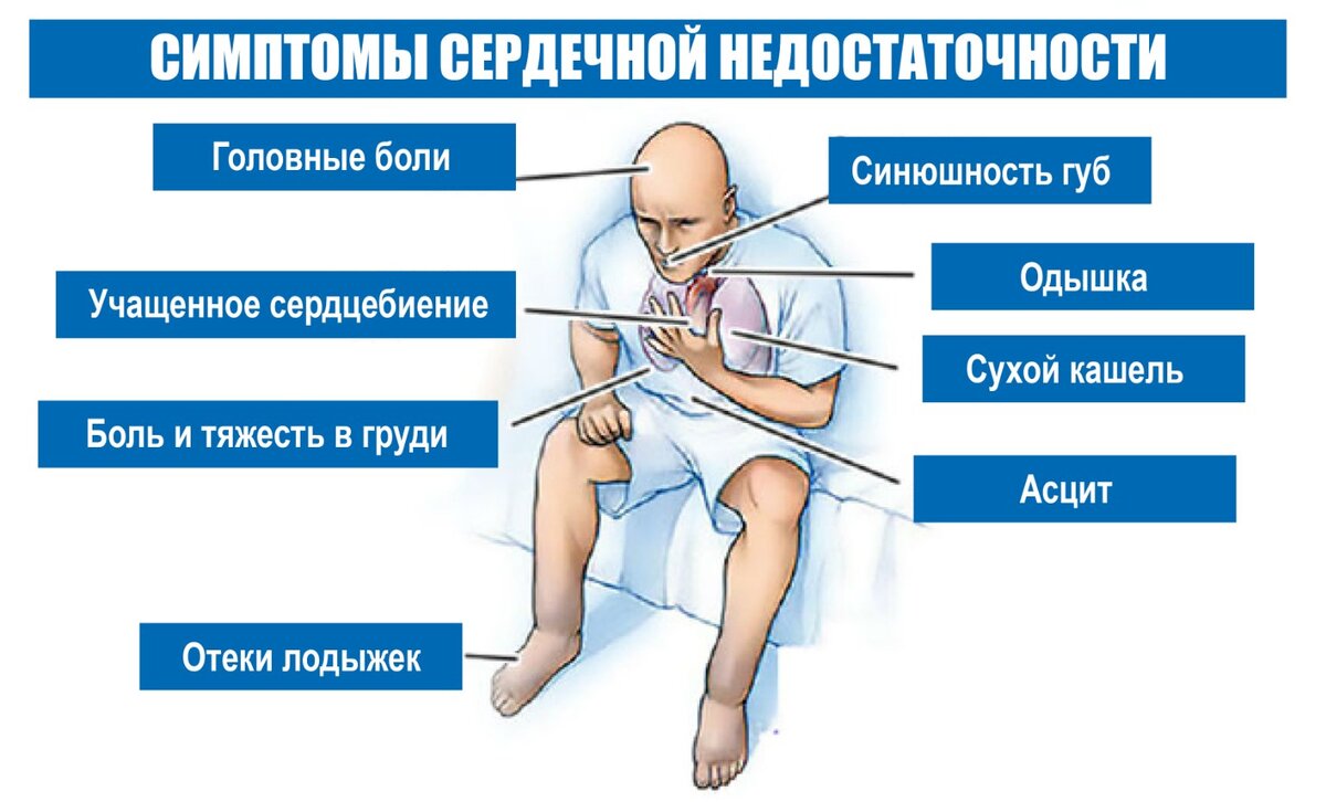 Как по кашлю понять, что сердце просит о помощи | Газета Хозяйство | Дзен