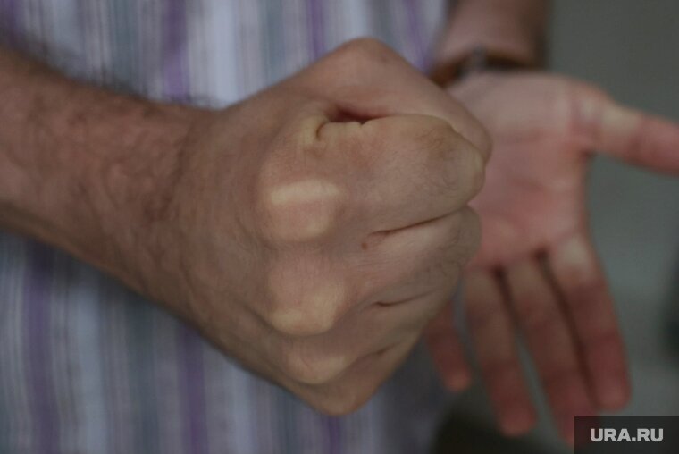    Мужчина часто избивал свою беременную жену