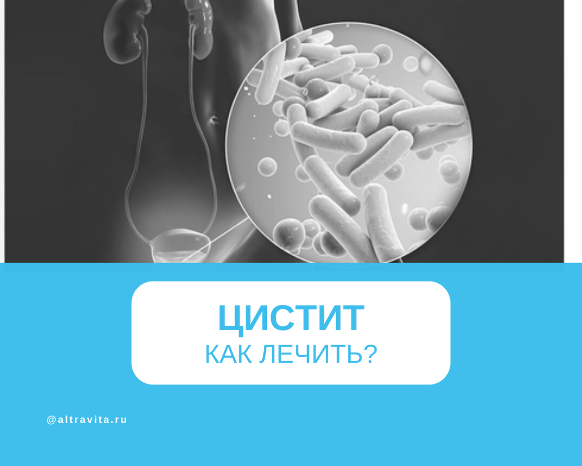Цистит: как лечить?