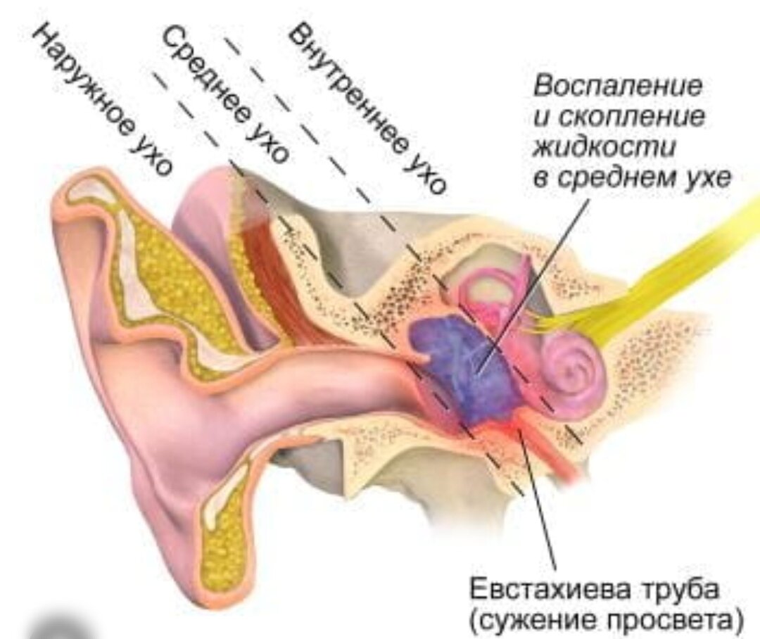 С отитом можно гулять