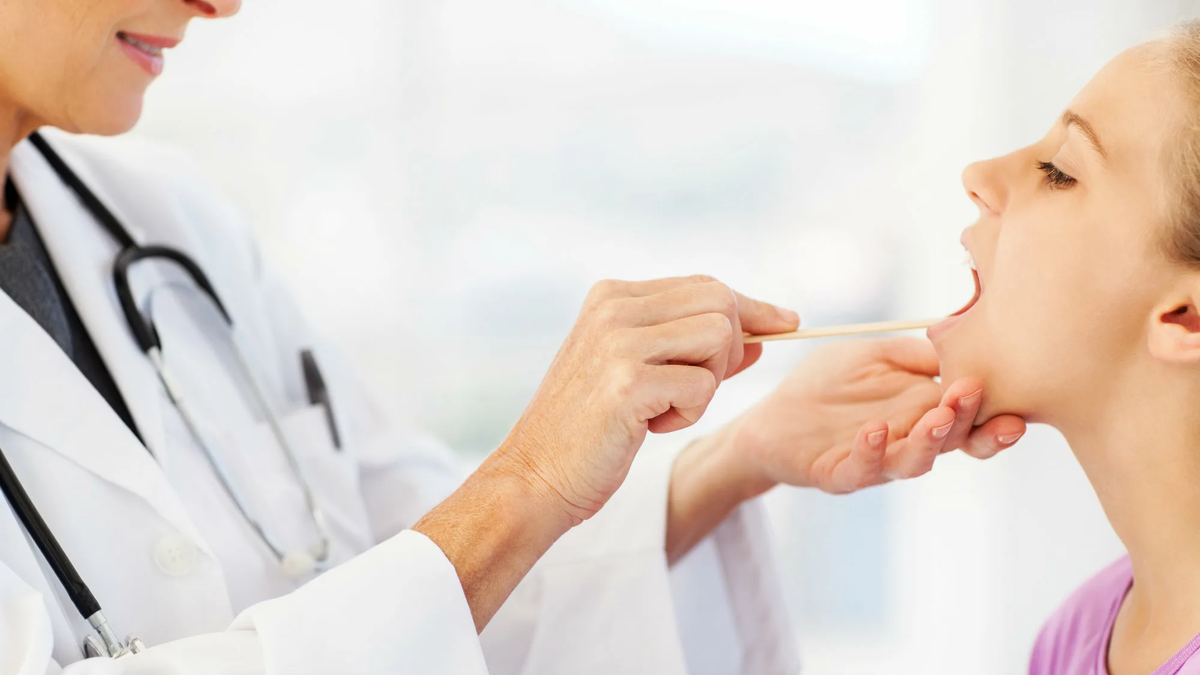 Санация ротовой полости. Грибковый (кандидозный) стоматит. Прием лор врача. Врач осматривает. Язык врачей.