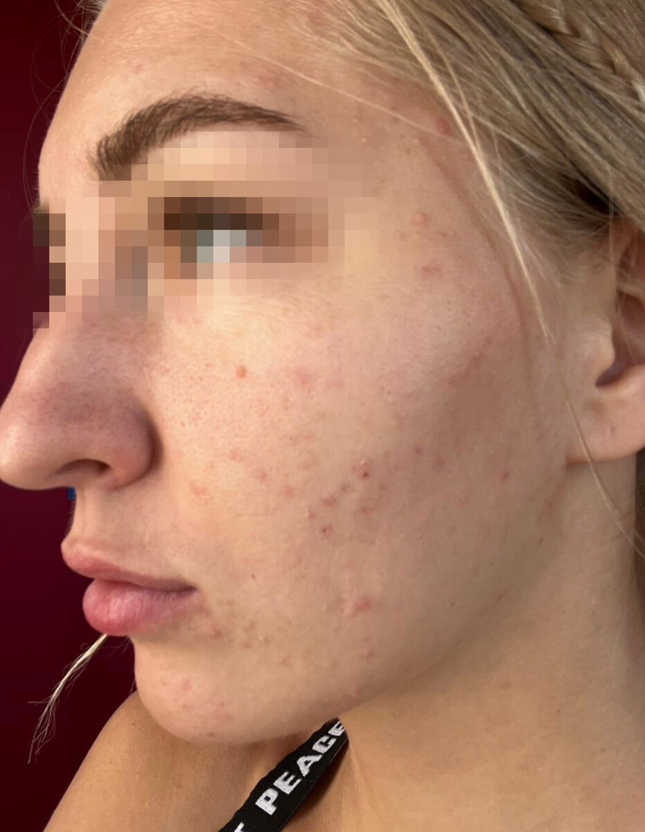 Пациент ДО онлайн консультации