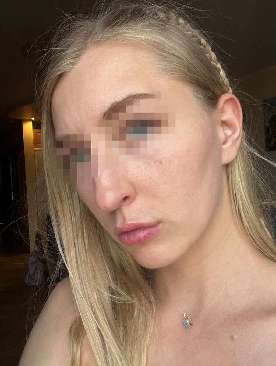 Пациент ПОСЛЕ лечения онлайн