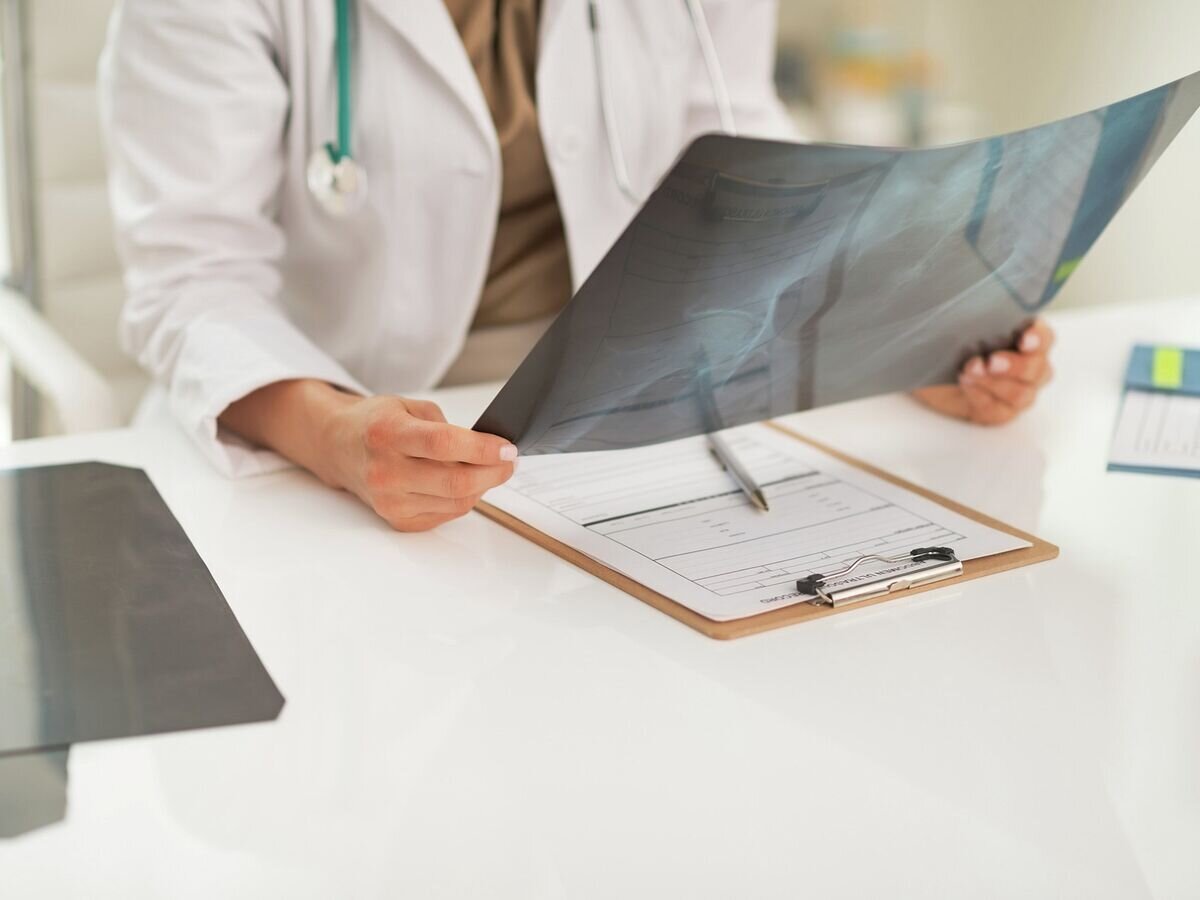    Врач изучает рентгеновский снимок пациента© Fotolia / Alliance