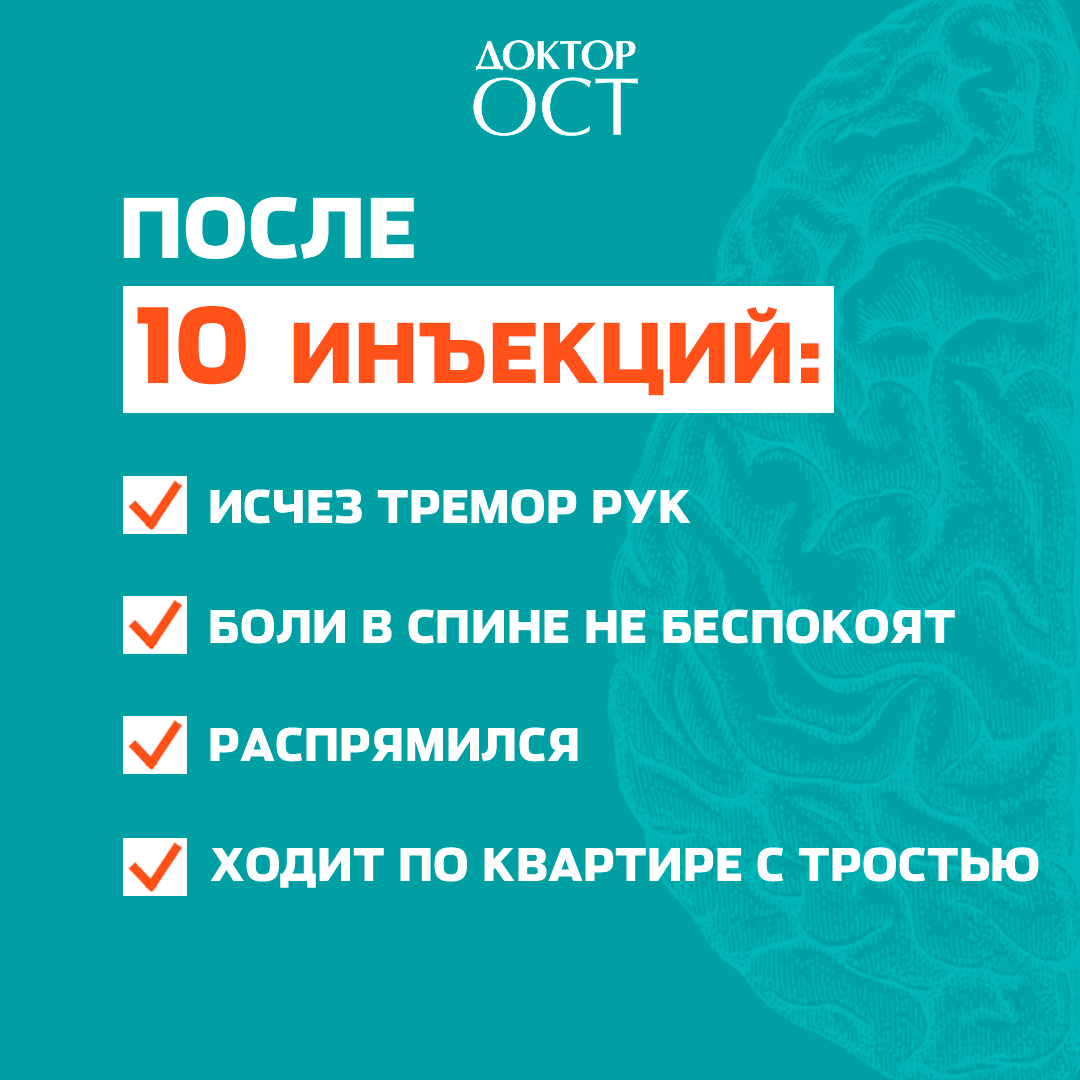 Лечение рассеянного склероза | Доктор ОСТ | Центр лечения позвоночника ...