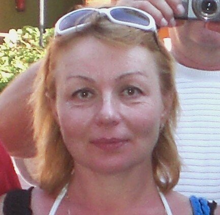 Примерно за год до первой блефаропластики