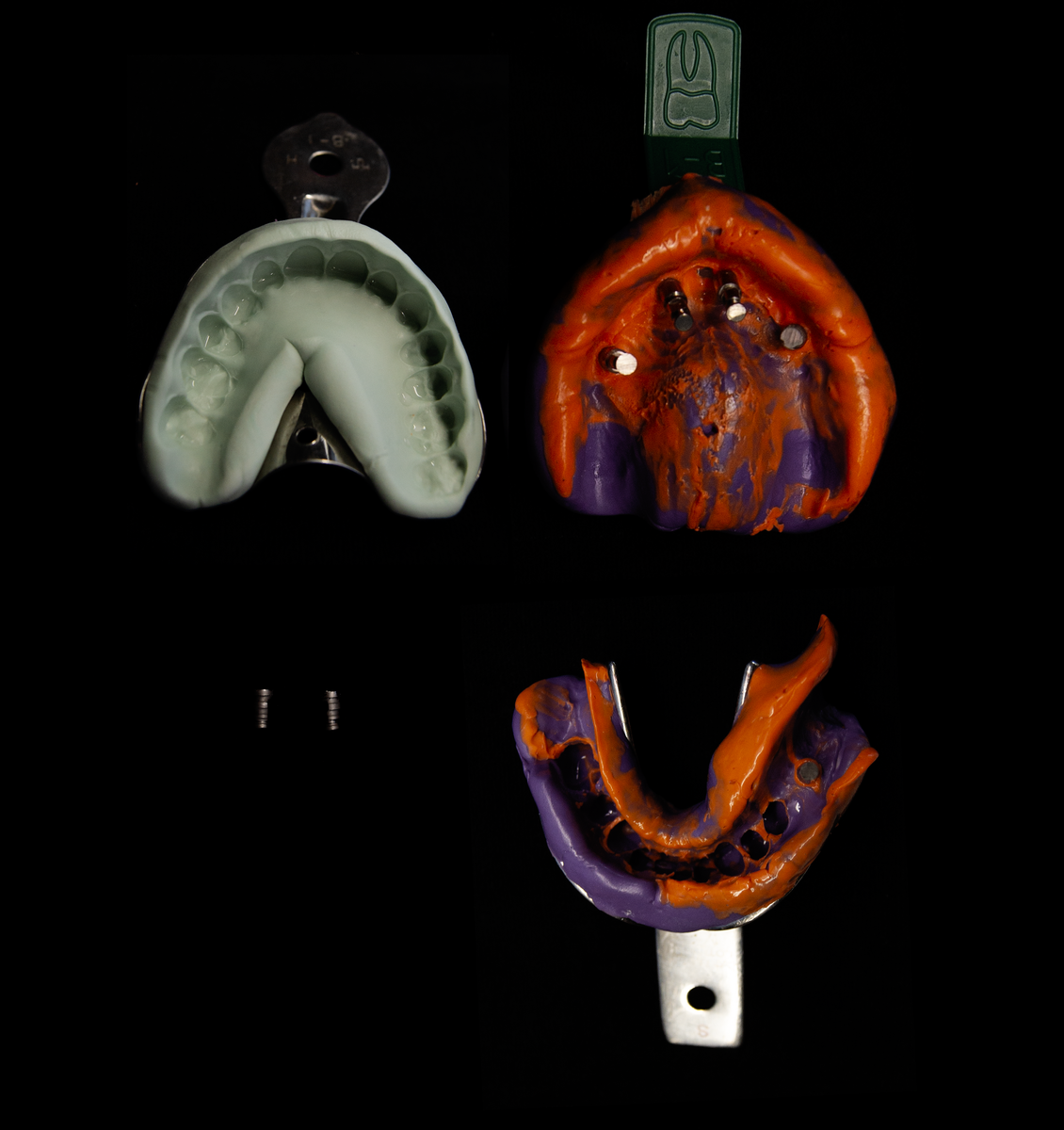 Первоначальный набор слепков для выполнения зуботехнической работы.