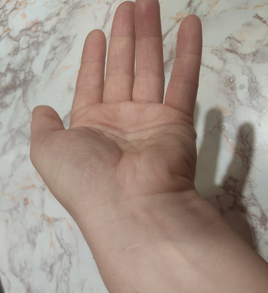 Шрамик на запястье - напоминание об ожидании чуда