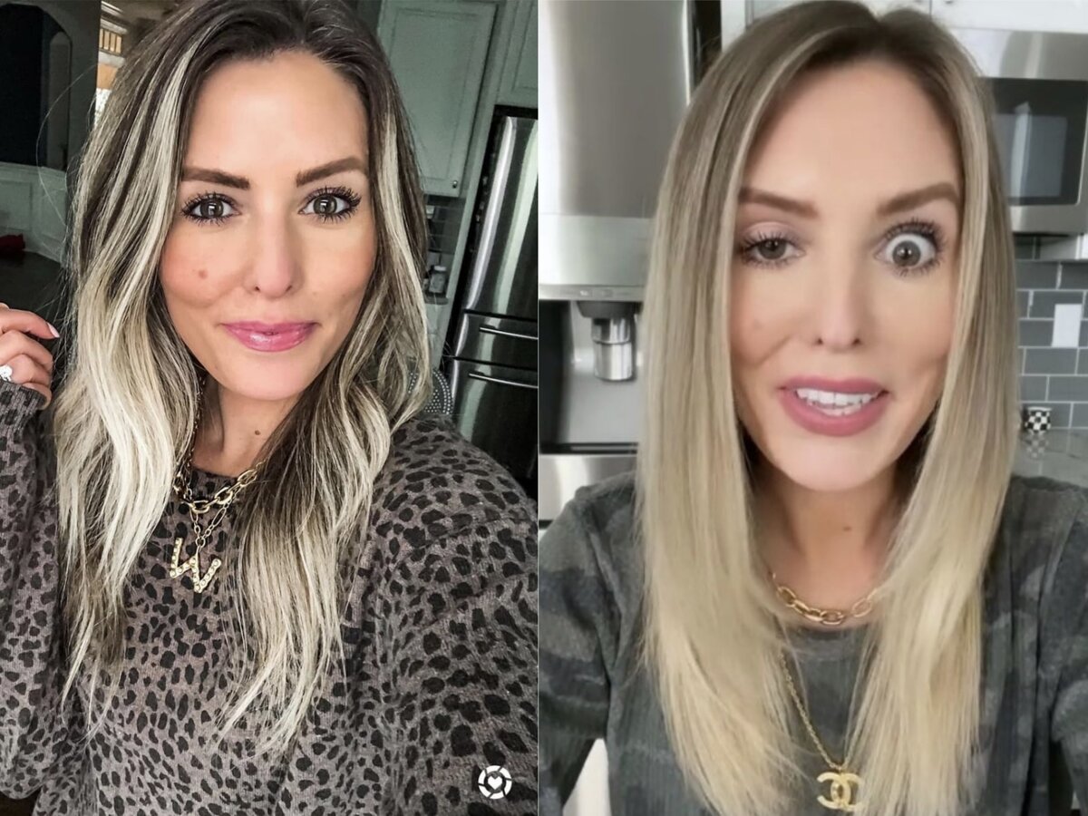 Американская блогер Уитни Буха. Осложнения после ботокса  