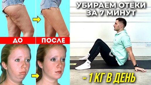 Télécharger la video: Лимфодренажная зарядка для похудения. Убираем отеки без прыжков за 7 минут дома