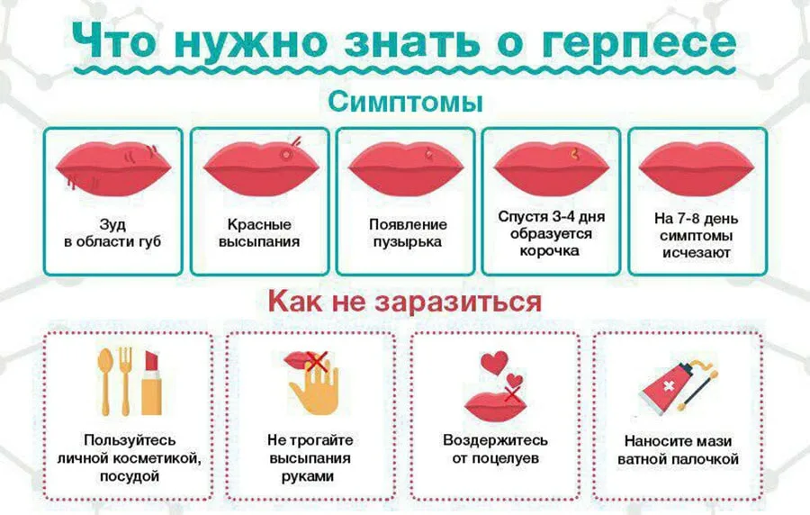 Чем лечить герпес(малярию, простуду) на губах?