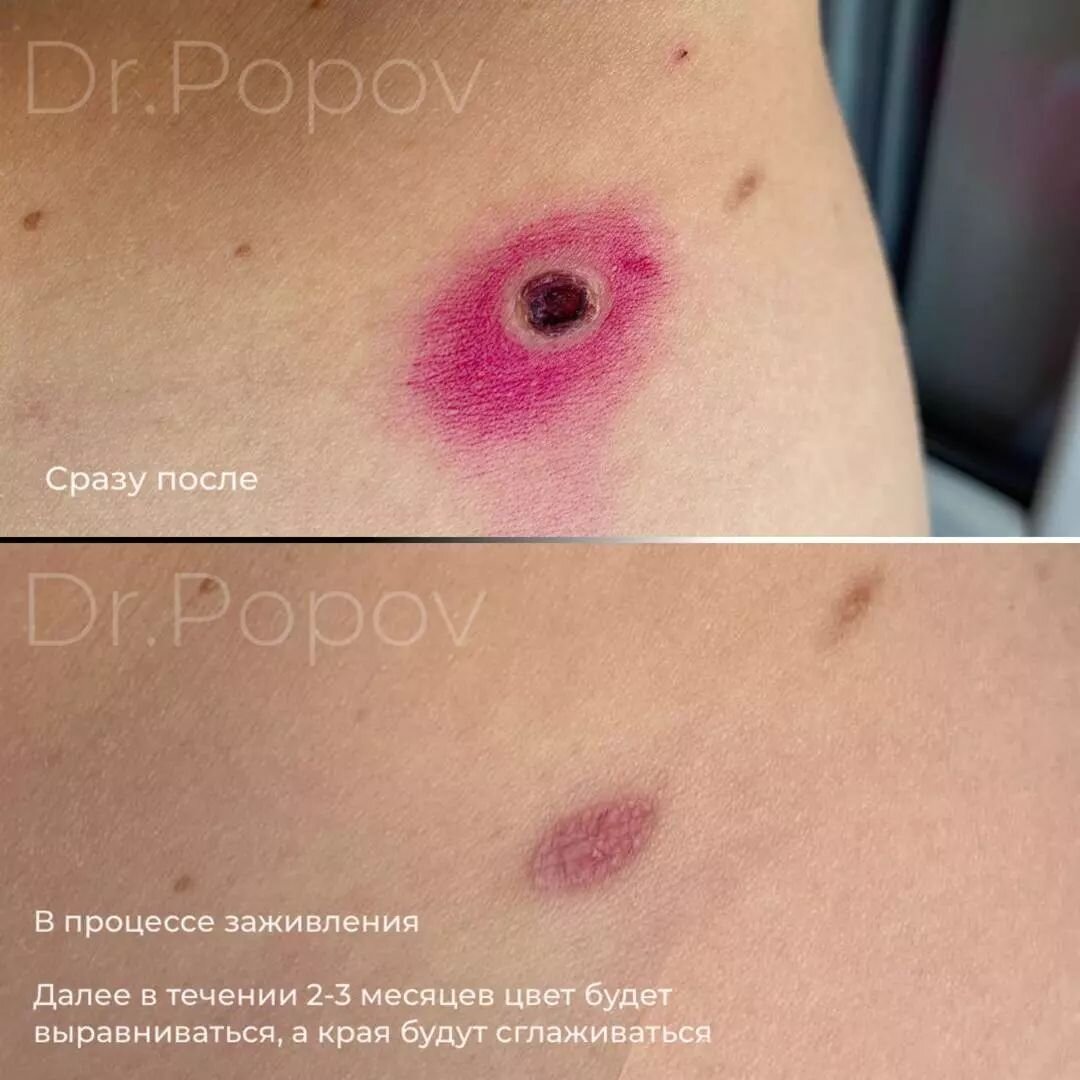 Врач-дерматоонколог Попов Михаил Сергеевич