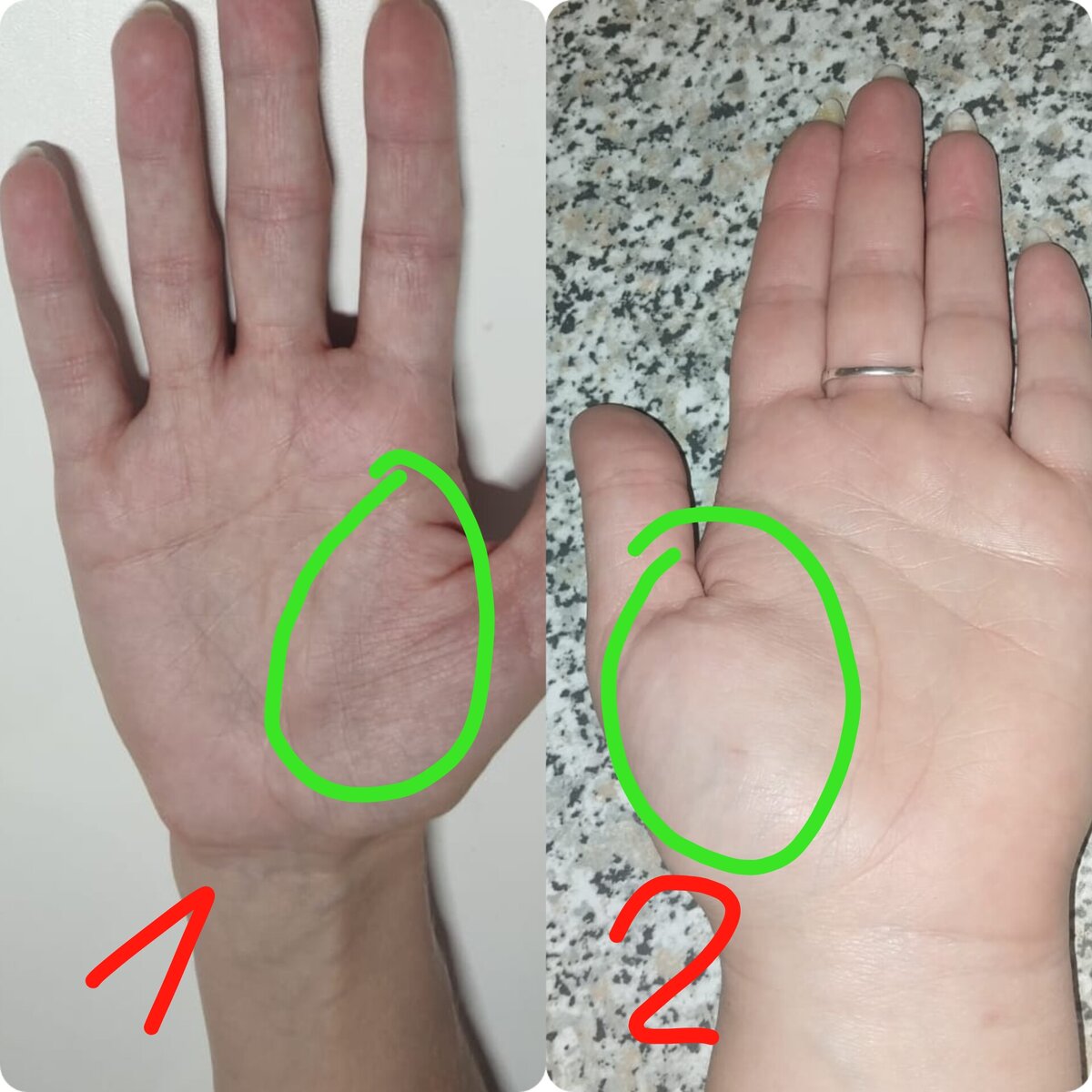 Холм Венеры. 1 -плоский, 2-полный.