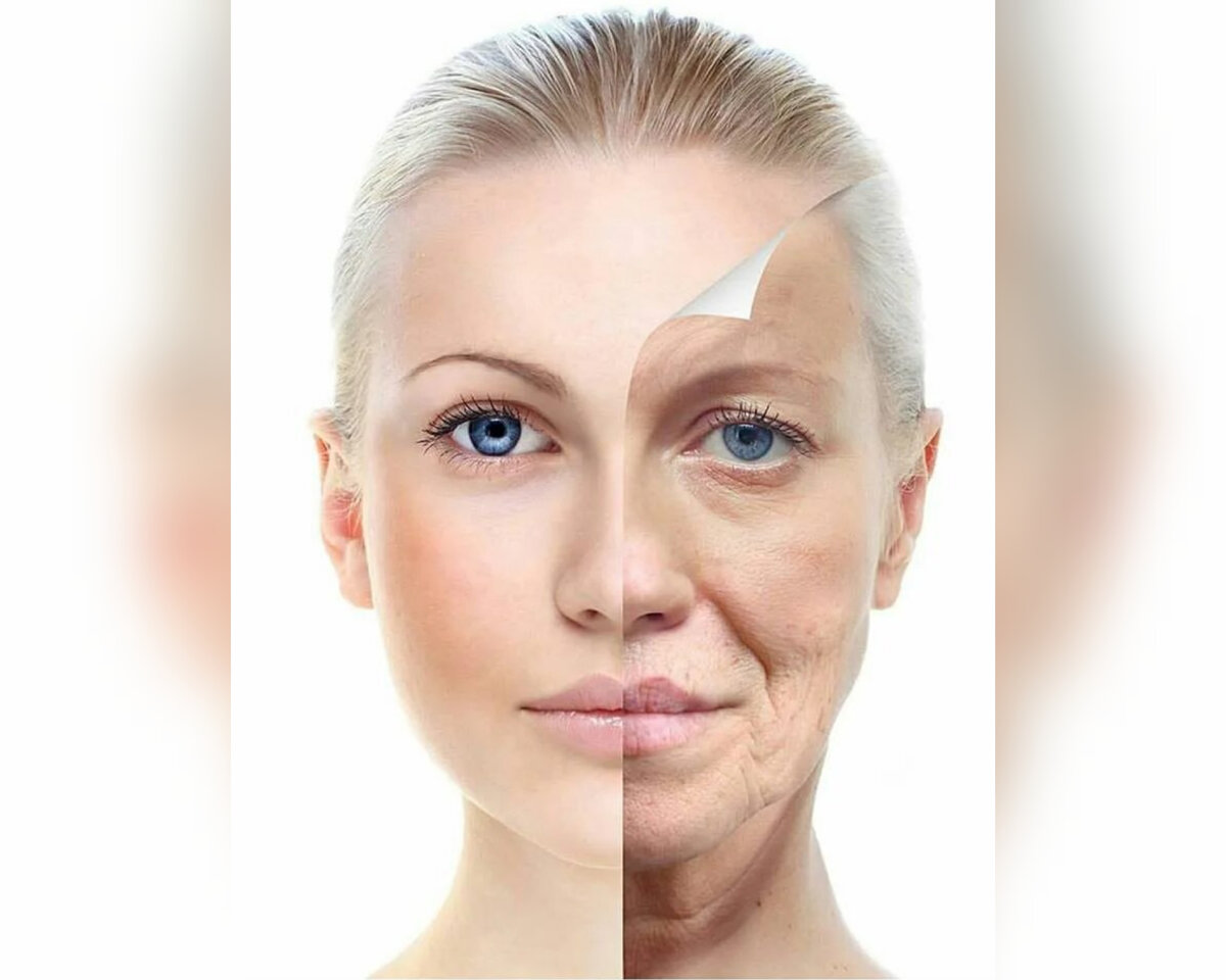 Омоложение кожи лица. 