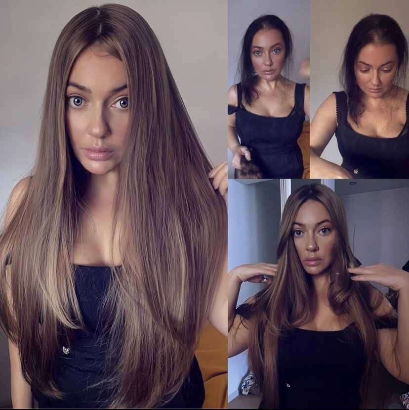 система замещения волос 