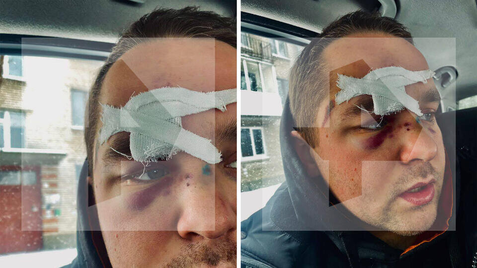 Фото: © РЕН ТВ